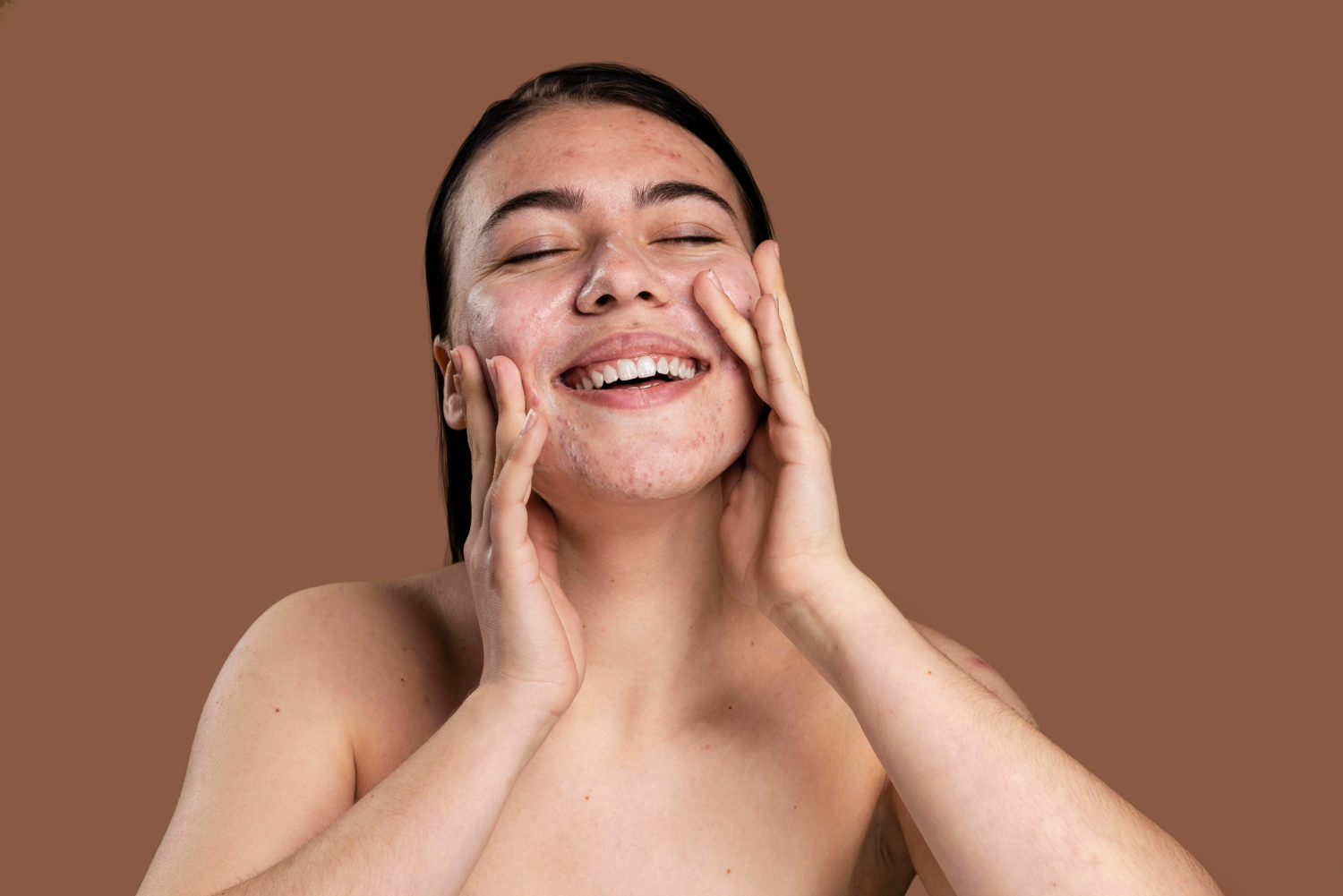 Đẩy mụn là gì? Hiểu đúng quá trình đẩy mụn để trị mụn hiệu quả