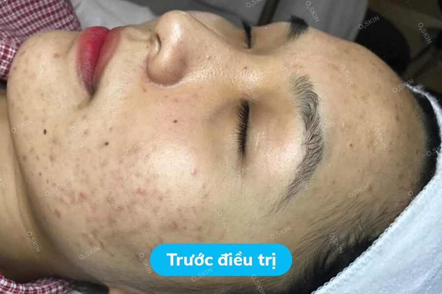 Nghiem-Ho-Nhuoc-Nam-3