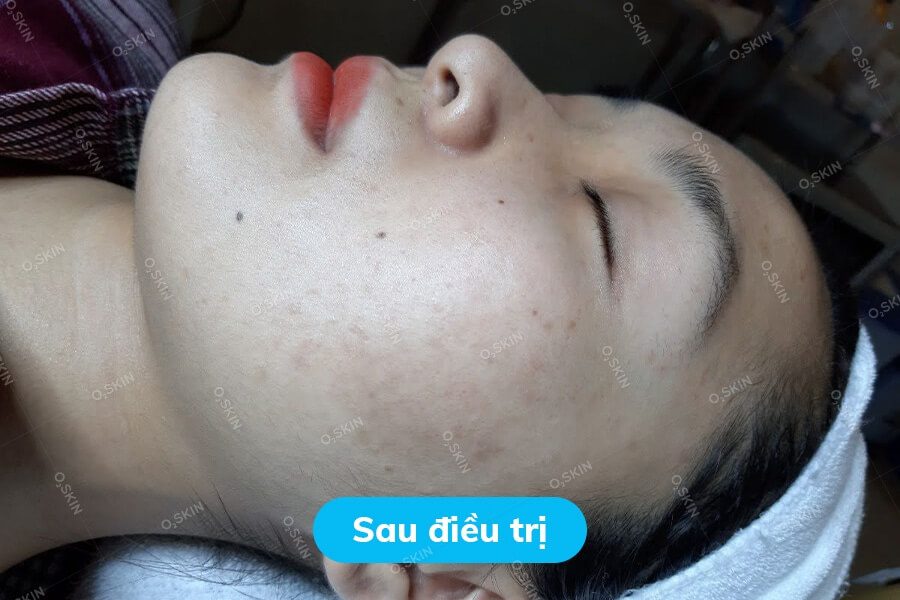 Nghiem-Ho-Nhuoc-Nam-4