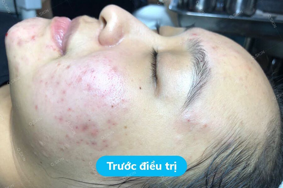 Tran-Thi-Thanh-Phuong-3