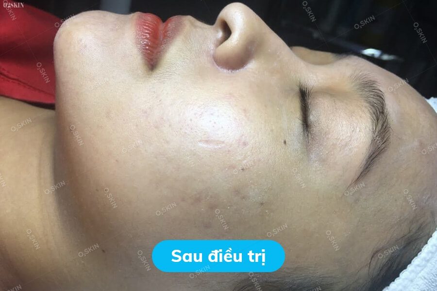 Tran-Thi-Thanh-Phuong-4