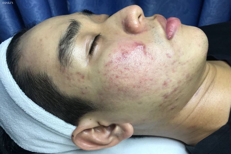 tong-nguyen-thanh-binh-1