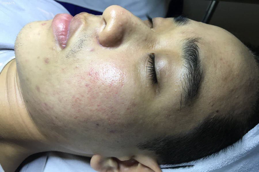 tong-nguyen-thanh-binh-2